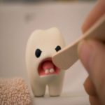 أسباب تسوس الأسنان